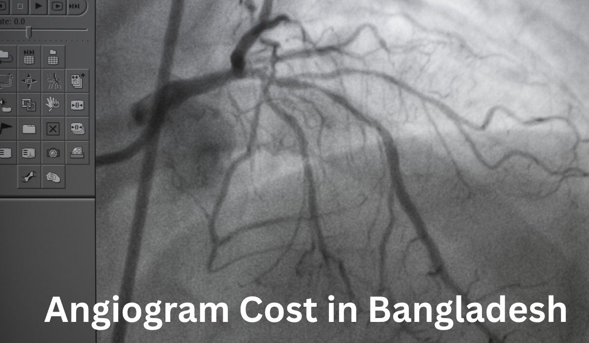Angiogram Cost in Bangladesh – Complete Information