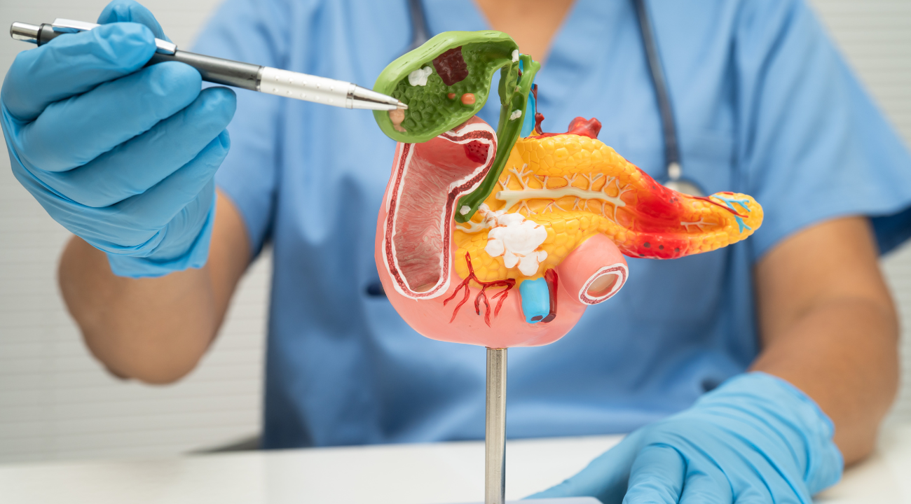 Gallbladder Stone Operation: A Complete Guide to Surgery, Cost, Tests, and Alternatives