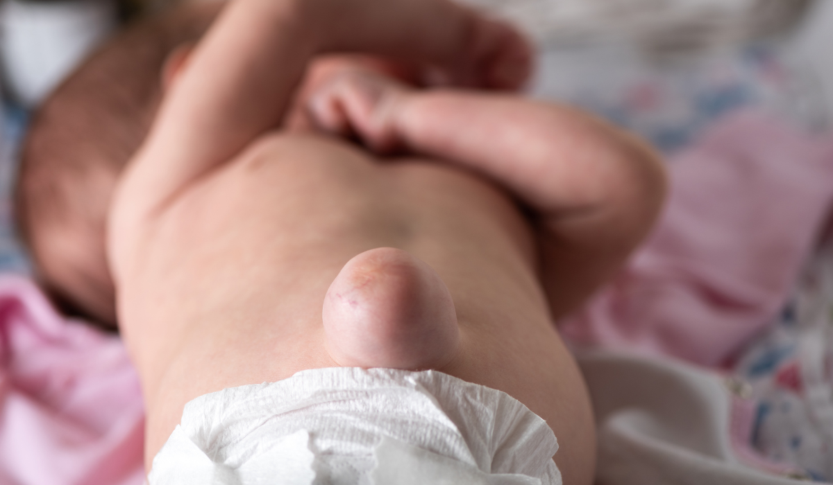 Hernia and Hernia Surgery: All Information for Bangladeshi Patients