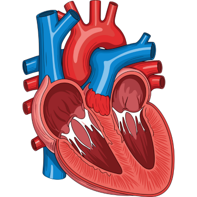 Heart Valve Replacement