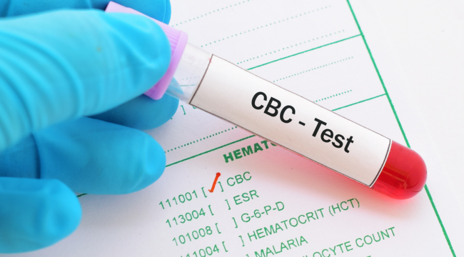 CBC Test Price in Bangladesh – Cost, Procedure & Importance