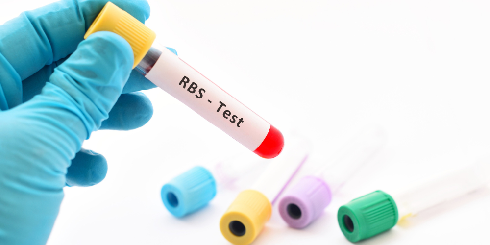 RBS Test Price in Bangladesh 2026 – Hospital wise Cost