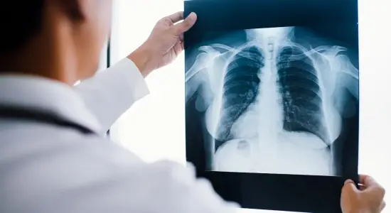 Best Chest Specialist in Dhaka – Get Expert Respiratory Care