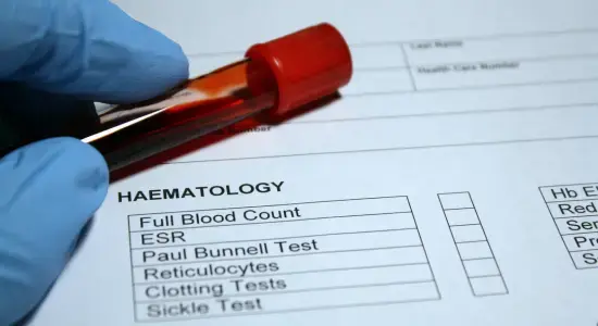 Best Hematology Doctor in Dhaka – Expert Blood Disorder Treatment