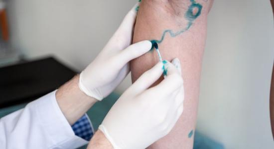 Vascular Surgery Doctors for Advanced Blood Vessel Care